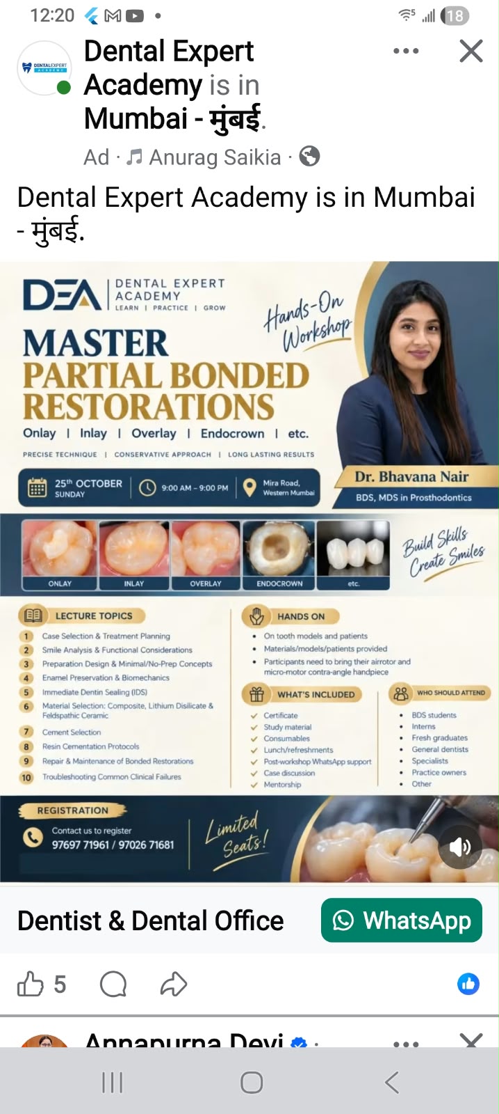 Master Partial Bonded Restorations — Hands-On Workshop (Onlay, Inlay, Overlay, Endocrown)